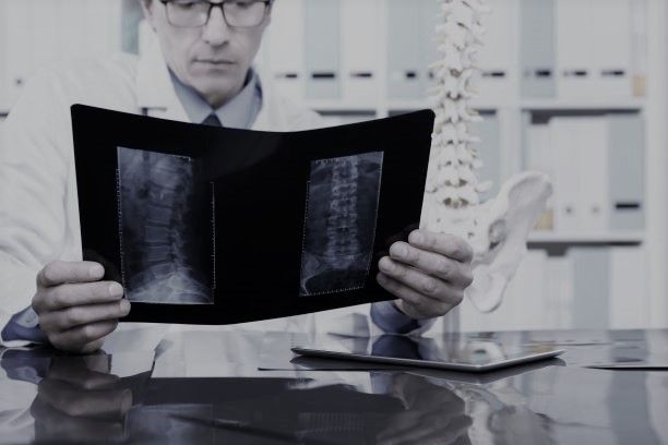 doctor studying xray of a spine